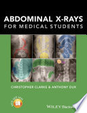 Abdominal X-rays for Medical Students