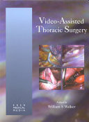 Video-Assisted Thoracic Surgery