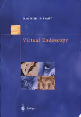 Virtual Endoscopy
