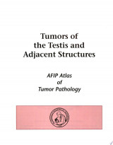 Tumors of the Testis and Adjacent Structures