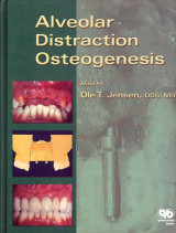 Alveolar Distraction Osteogenesis