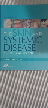 The skin and systemic disease.A color atlas ant text.