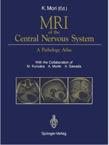 MRI of the Central Nervous System: A Pathology Atlas