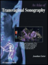 An Atlas of Transvaginal Sonography