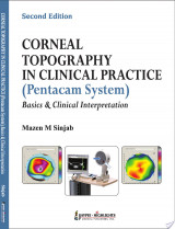 Corneal Topography in Clinical Practice (Pentacam System) Basics and Clinical Interpretation