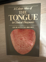 The tongue in clinical diagnosis