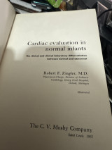 Cardiac evaluation in normal infants